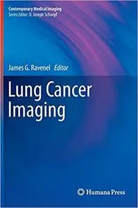 Lung Cancer Imaging