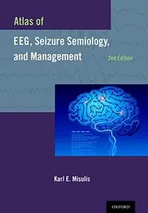 Atlas of EEG, Seizure Semiology, and Management 2nd Edition