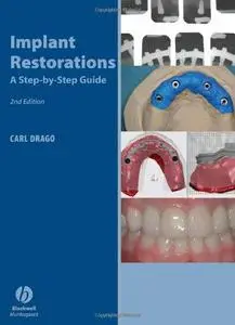 Implant Restorations: A Step-by-Step Guide, 2nd Edition