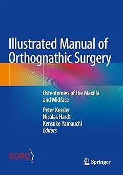 Illustrated Manual of Orthognathic Surgery: Osteotomies of the Maxilla and Midface