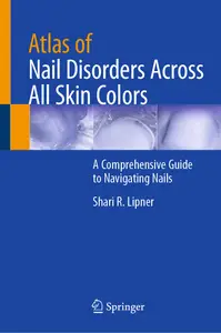 Atlas of Nail Disorders Across All Skin Colors: A Comprehensive Guide to Navigating Nails